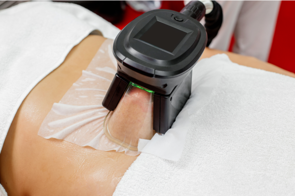 Fat Freezing